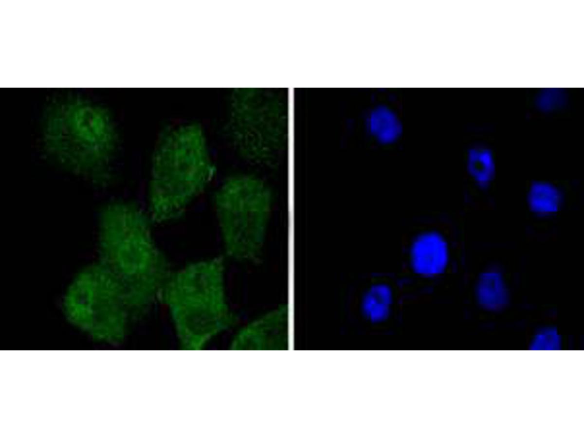 ICC staining of KAP1 in A549 cells (green). Formalin fixed cells were permeabilized with 0.1% Triton X-100 in TBS for 10 minutes at room temperature and blocked with 1% Blocker BSA for 15 minutes at room temperature. Cells were probed with the primary antibody (ET1612-55, 1/50) for 1 hour at room temperature, washed with PBS. Alexa Fluor®488 Goat anti-Rabbit IgG was used as the secondary antibody at 1/1,000 dilution. The nuclear counter stain is DAPI (blue).