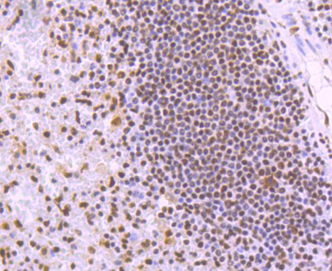 Immunohistochemical analysis of paraffin-embedded human spleen tissue using anti-KAP1 antibody. The section was pre-treated using heat mediated antigen retrieval with Tris-EDTA buffer (pH 8.0-8.4) for 20 minutes.The tissues were blocked in 5% BSA for 30 minutes at room temperature, washed with ddH2O and PBS, and then probed with the primary antibody (ET1612-55, 1/50) for 30 minutes at room temperature. The detection was performed using an HRP conjugated compact polymer system. DAB was used as the chromogen. Tissues were counterstained with hematoxylin and mounted with DPX.