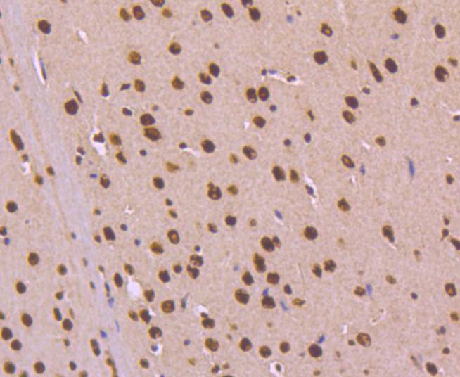 Immunohistochemical analysis of paraffin-embedded mouse brain tissue using anti-KAP1 antibody. The section was pre-treated using heat mediated antigen retrieval with Tris-EDTA buffer (pH 8.0-8.4) for 20 minutes.The tissues were blocked in 5% BSA for 30 minutes at room temperature, washed with ddH2O and PBS, and then probed with the primary antibody (ET1612-55, 1/50) for 30 minutes at room temperature. The detection was performed using an HRP conjugated compact polymer system. DAB was used as the chromogen. Tissues were counterstained with hematoxylin and mounted with DPX.