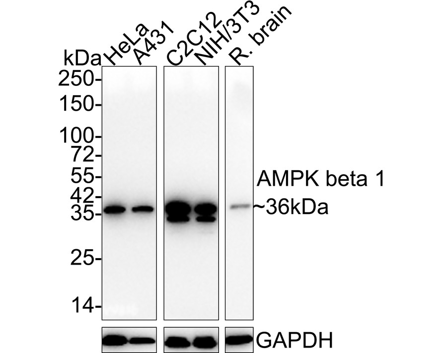 Western blot analysis of AMPK beta 1 on A431 cell lysates. Proteins were transferred to a PVDF membrane and blocked with 5% BSA in PBS for 1 hour at room temperature. The primary antibody (ET1612-56, 1/500) was used in 5% BSA at room temperature for 2 hours. Goat Anti-Rabbit IgG - HRP Secondary Antibody (HA1001) at 1:5,000 dilution was used for 1 hour at room temperature.