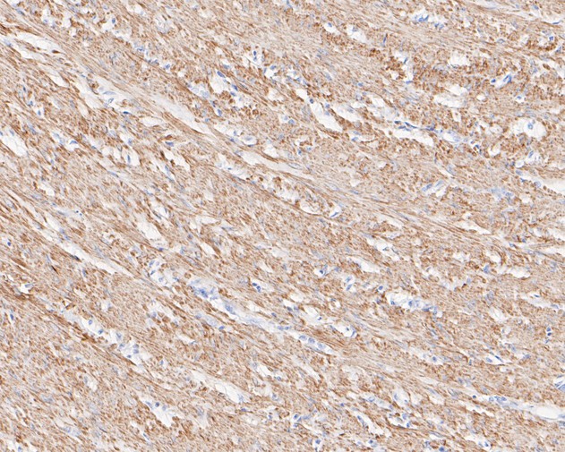 Immunohistochemical analysis of paraffin-embedded human smooth muscle tissue using anti-AMPK beta 1 antibody. The section was pre-treated using heat mediated antigen retrieval with sodium citrate buffer (pH 6.0) for 20 minutes. The tissues were blocked in 5% BSA for 30 minutes at room temperature, washed with ddH2O and PBS, and then probed with the primary antibody (ET1612-56, 1/200)  for 30 minutes at room temperature. The detection was performed using an HRP conjugated compact polymer system. DAB was used as the chromogen. Tissues were counterstained with hematoxylin and mounted with DPX.