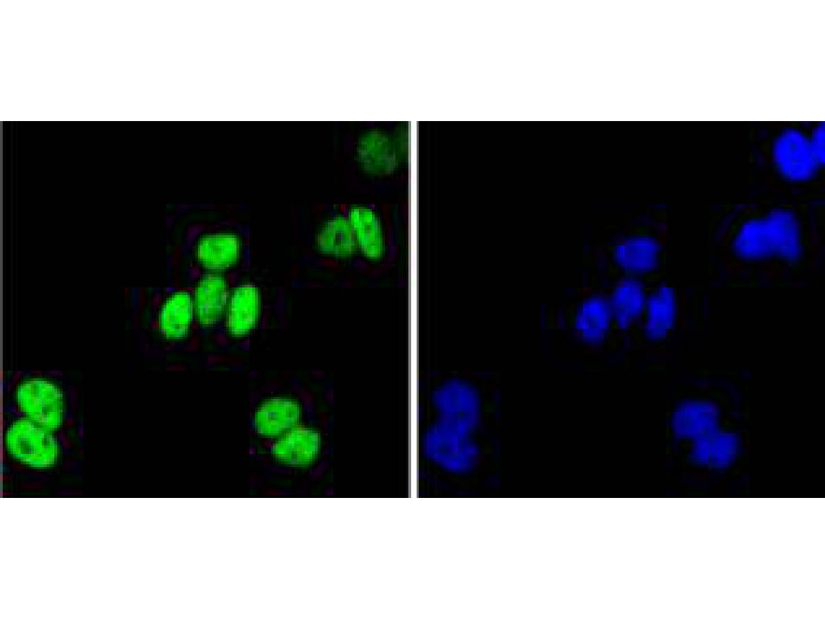 ICC staining of JunB in Hela cells (green). Formalin fixed cells were permeabilized with 0.1% Triton X-100 in TBS for 10 minutes at room temperature and blocked with 1% Blocker BSA for 15 minutes at room temperature. Cells were probed with the primary antibody (ET1612-57, 1/50) for 1 hour at room temperature, washed with PBS. Alexa Fluor®488 Goat anti-Rabbit IgG was used as the secondary antibody at 1/1,000 dilution. The nuclear counter stain is DAPI (blue).