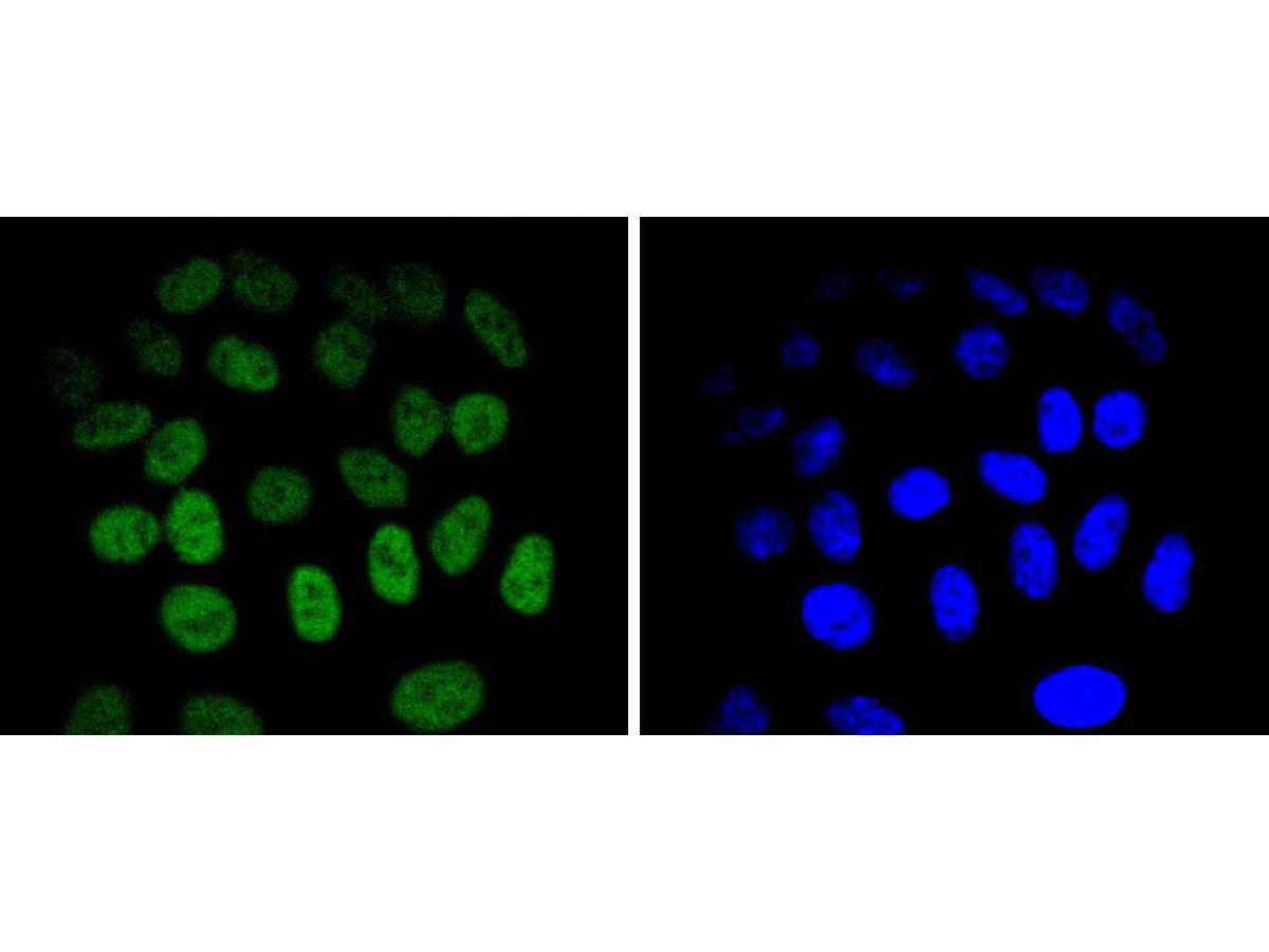 ICC staining of JunB in HepG2 cells (green). Formalin fixed cells were permeabilized with 0.1% Triton X-100 in TBS for 10 minutes at room temperature and blocked with 1% Blocker BSA for 15 minutes at room temperature. Cells were probed with the primary antibody (ET1612-57, 1/50) for 1 hour at room temperature, washed with PBS. Alexa Fluor®488 Goat anti-Rabbit IgG was used as the secondary antibody at 1/1,000 dilution. The nuclear counter stain is DAPI (blue).