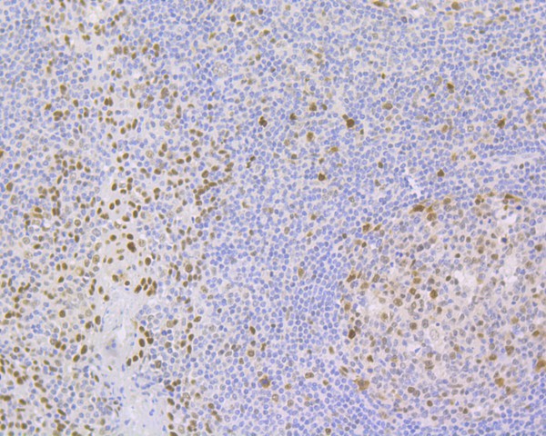 Immunohistochemical analysis of paraffin-embedded human tonsil tissue using anti-JunB antibody. The section was pre-treated using heat mediated antigen retrieval with Tris-EDTA buffer (pH 8.0-8.4) for 20 minutes.The tissues were blocked in 5% BSA for 30 minutes at room temperature, washed with ddH2O and PBS, and then probed with the primary antibody (ET1612-57, 1/50) for 30 minutes at room temperature. The detection was performed using an HRP conjugated compact polymer system. DAB was used as the chromogen. Tissues were counterstained with hematoxylin and mounted with DPX.