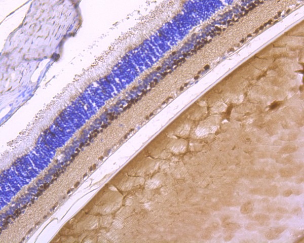 Immunohistochemical analysis of paraffin-embedded rat eyeball tissue using anti-PAX6 antibody. The section was pre-treated using heat mediated antigen retrieval with Tris-EDTA buffer (pH 8.0-8.4) for 20 minutes.The tissues were blocked in 5% BSA for 30 minutes at room temperature, washed with ddH2O and PBS, and then probed with the primary antibody (ET1612-58, 1/200) for 30 minutes at room temperature. The detection was performed using an HRP conjugated compact polymer system. DAB was used as the chromogen. Tissues were counterstained with hematoxylin and mounted with DPX.