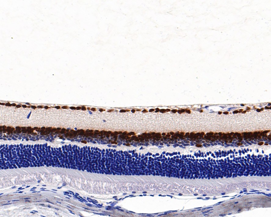 Immunohistochemical analysis of paraffin-embedded mouse eyeball tissue with Rabbit anti-PAX6 antibody (ET1612-58) at 1/1,000 dilution.<br />
<br />
The section was pre-treated using heat mediated antigen retrieval with Tris-EDTA buffer (pH 9.0) for 20 minutes. The tissues were blocked in 1% BSA for 20 minutes at room temperature, washed with ddH2O and PBS, and then probed with the primary antibody (ET1612-58) at 1/1,000 dilution for 1 hour at room temperature. The detection was performed using an HRP conjugated compact polymer system. DAB was used as the chromogen. Tissues were counterstained with hematoxylin and mounted with DPX.