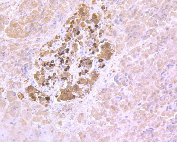 Immunohistochemical analysis of paraffin-embedded human pancreas tissue using anti-PAX6 antibody. The section was pre-treated using heat mediated antigen retrieval with Tris-EDTA buffer (pH 8.0-8.4) for 20 minutes.The tissues were blocked in 5% BSA for 30 minutes at room temperature, washed with ddH2O and PBS, and then probed with the primary antibody (ET1612-58, 1/50) for 30 minutes at room temperature. The detection was performed using an HRP conjugated compact polymer system. DAB was used as the chromogen. Tissues were counterstained with hematoxylin and mounted with DPX.