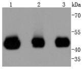 Western blot analysis of MEK2 on different lysates. Proteins were transferred to a PVDF membrane and blocked with 5% BSA in PBS for 1 hour at room temperature. The primary antibody (ET1612-6, 1/500) was used in 5% BSA at room temperature for 2 hours. Goat Anti-Rabbit IgG - HRP Secondary Antibody (HA1001) at 1:200,000 dilution was used for 1 hour at room temperature.<br />
Positive control: <br />
Lane 1: Jurkat cell lysate<br />
Lane 2: Hela cell lysate<br />
Lane 3: 293T cell lysate<br />
<br />
Predicted band size: 44 kDa<br />
Observed band size: 44 kDa