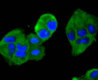 ICC staining of MEK2 in Hela cells (green). Formalin fixed cells were permeabilized with 0.1% Triton X-100 in TBS for 10 minutes at room temperature and blocked with 10% negative goat serum for 15 minutes at room temperature. Cells were probed with the primary antibody (ET1612-6, 1/50) for 1 hour at room temperature, washed with PBS. Alexa Fluor®488 conjugate-Goat anti-Rabbit IgG was used as the secondary antibody at 1/1,000 dilution. The nuclear counter stain is DAPI (blue).