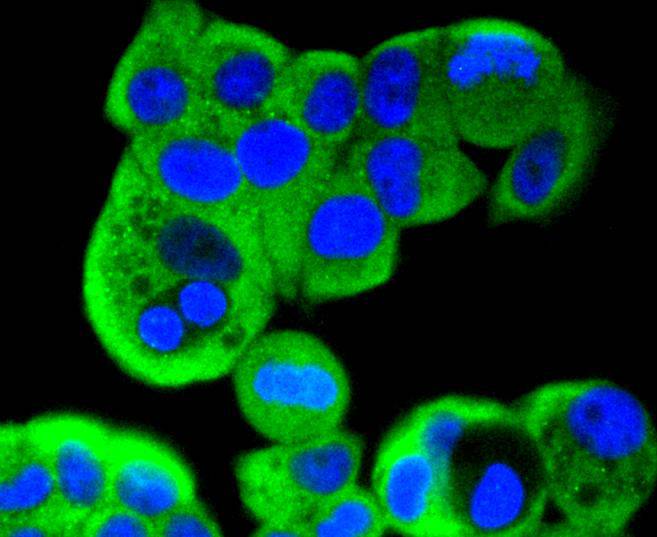 ICC staining of MEK2 in MCF-7 cells (green). Formalin fixed cells were permeabilized with 0.1% Triton X-100 in TBS for 10 minutes at room temperature and blocked with 10% negative goat serum for 15 minutes at room temperature. Cells were probed with the primary antibody (ET1612-6, 1/50) for 1 hour at room temperature, washed with PBS. Alexa Fluor®488 conjugate-Goat anti-Rabbit IgG was used as the secondary antibody at 1/1,000 dilution. The nuclear counter stain is DAPI (blue).