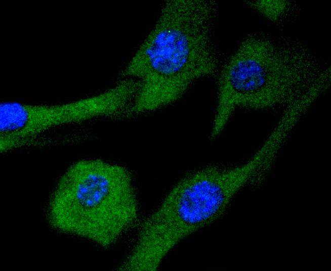 ICC staining of MEK2 in NIH/3T3 cells (green). Formalin fixed cells were permeabilized with 0.1% Triton X-100 in TBS for 10 minutes at room temperature and blocked with 10% negative goat serum for 15 minutes at room temperature. Cells were probed with the primary antibody (ET1612-6, 1/50) for 1 hour at room temperature, washed with PBS. Alexa Fluor®488 conjugate-Goat anti-Rabbit IgG was used as the secondary antibody at 1/1,000 dilution. The nuclear counter stain is DAPI (blue).