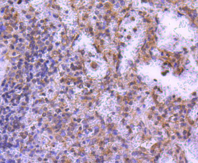 Immunohistochemical analysis of paraffin-embedded human spleen tissue using anti-MEK2 antibody. The section was pre-treated using heat mediated antigen retrieval with Tris-EDTA buffer (pH 9.0) for 20 minutes.The tissues were blocked in 1% BSA for 30 minutes at room temperature, washed with ddH2O and PBS, and then probed with the primary antibody (ET1612-6, 1/50) for 30 minutes at room temperature. The detection was performed using an HRP conjugated compact polymer system. DAB was used as the chromogen. Tissues were counterstained with hematoxylin and mounted with DPX.