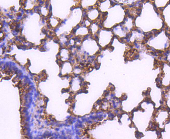 Immunohistochemical analysis of paraffin-embedded mouse lung tissue using anti-MEK2 antibody. The section was pre-treated using heat mediated antigen retrieval with Tris-EDTA buffer (pH 9.0) for 20 minutes.The tissues were blocked in 1% BSA for 30 minutes at room temperature, washed with ddH2O and PBS, and then probed with the primary antibody (ET1612-6, 1/50) for 30 minutes at room temperature. The detection was performed using an HRP conjugated compact polymer system. DAB was used as the chromogen. Tissues were counterstained with hematoxylin and mounted with DPX.