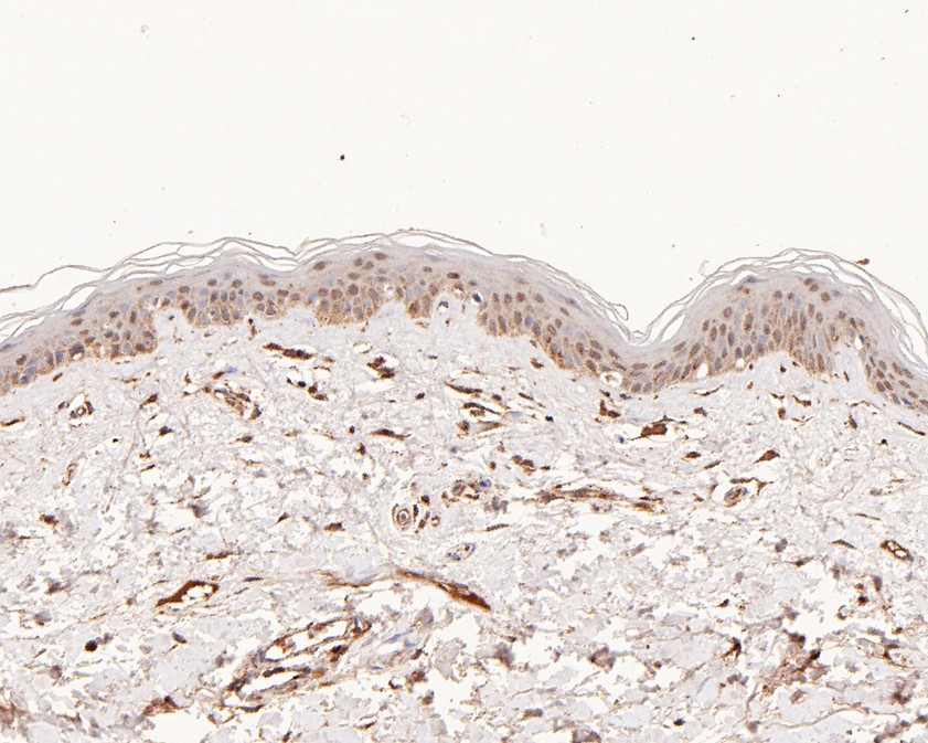 Immunohistochemical analysis of paraffin-embedded human skin tissue using anti-PAX7 antibody. The section was pre-treated using heat mediated antigen retrieval with sodium citrate buffer (pH 6.0) for 20 minutes. The tissues were blocked in 5% BSA for 30 minutes at room temperature, washed with ddH2O and PBS, and then probed with the primary antibody (ET1612-60, 1/50)  for 30 minutes at room temperature. The detection was performed using an HRP conjugated compact polymer system. DAB was used as the chromogen. Tissues were counterstained with hematoxylin and mounted with DPX.