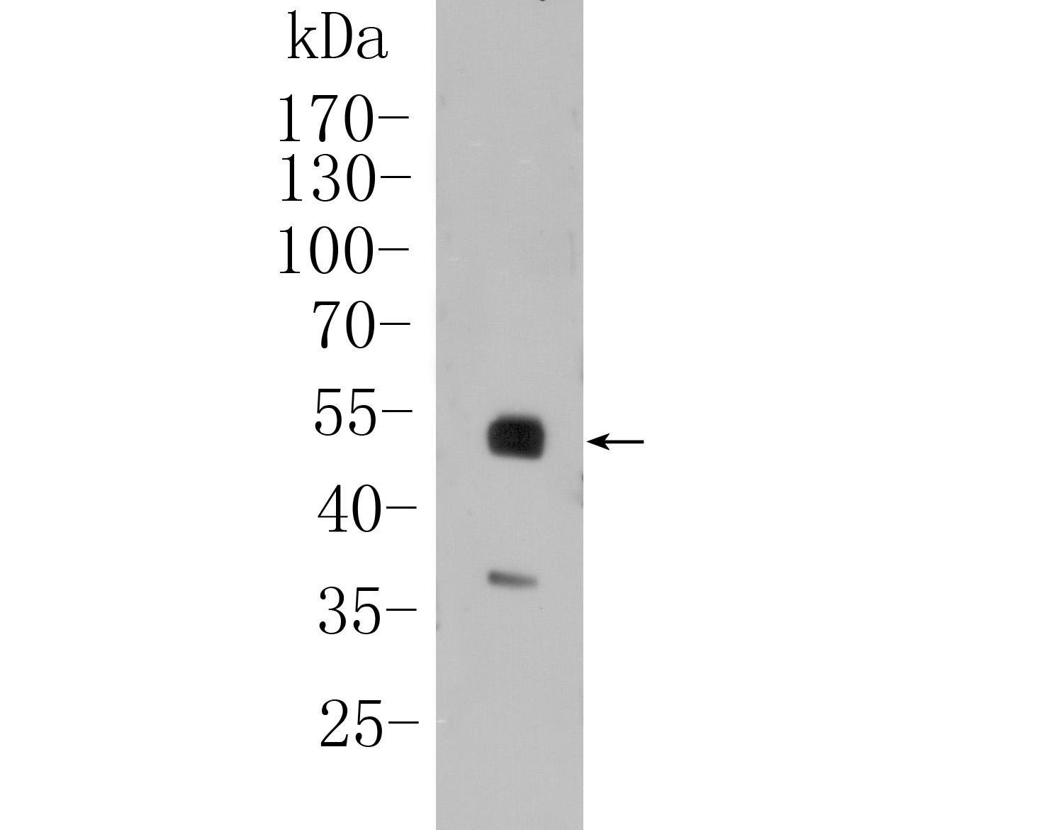 Western blot analysis of PAX8 on SKOV-3 cell lysate. Proteins were transferred to a PVDF membrane and blocked with 5% BSA in PBS for 1 hour at room temperature. The primary antibody (ET1612-61, 1/500) was used in 5% BSA at room temperature for 2 hours. Goat Anti-Rabbit IgG - HRP Secondary Antibody (HA1001) at 1:5,000 dilution was used for 1 hour at room temperature.