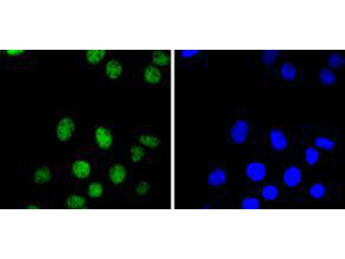 ICC staining PAX8 in SKOV-3 cells (green). The nuclear counter stain is DAPI (blue). Cells were fixed in paraformaldehyde, permeabilised with 0.25% Triton X100/PBS.