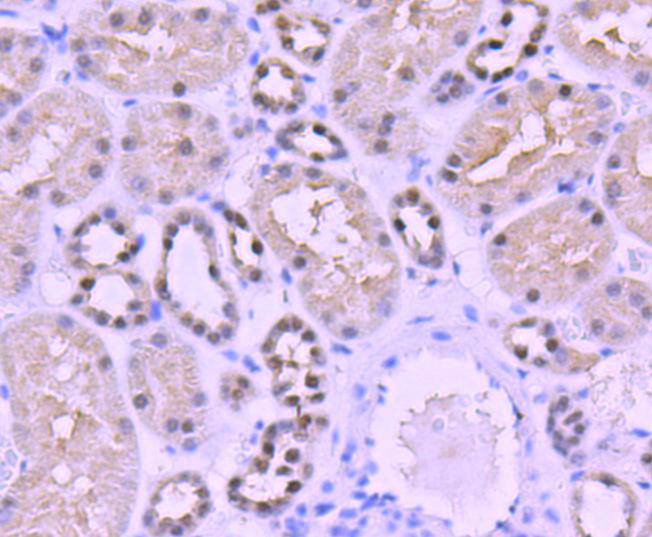 Immunohistochemical analysis of paraffin-embedded human kidney tissue using anti-PAX8 antibody. Counter stained with hematoxylin.