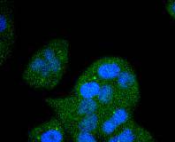ICC staining of FGFR1 in Hela cells (green). Formalin fixed cells were permeabilized with 0.1% Triton X-100 in TBS for 10 minutes at room temperature and blocked with 10% negative goat serum for 15 minutes at room temperature. Cells were probed with the primary antibody (ET1612-62, 1/50) for 1 hour at room temperature, washed with PBS. Alexa Fluor®488 conjugate-Goat anti-Rabbit IgG was used as the secondary antibody at 1/1,000 dilution. The nuclear counter stain is DAPI (blue).