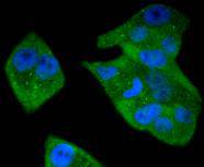ICC staining of STAT5b in Hela cells (green). Formalin fixed cells were permeabilized with 0.1% Triton X-100 in TBS for 10 minutes at room temperature and blocked with 10% negative goat serum for 15 minutes at room temperature. Cells were probed with the primary antibody (ET1612-63, 1/50) for 1 hour at room temperature, washed with PBS. Alexa Fluor®488 conjugate-Goat anti-Rabbit IgG was used as the secondary antibody at 1/1,000 dilution. The nuclear counter stain is DAPI (blue).