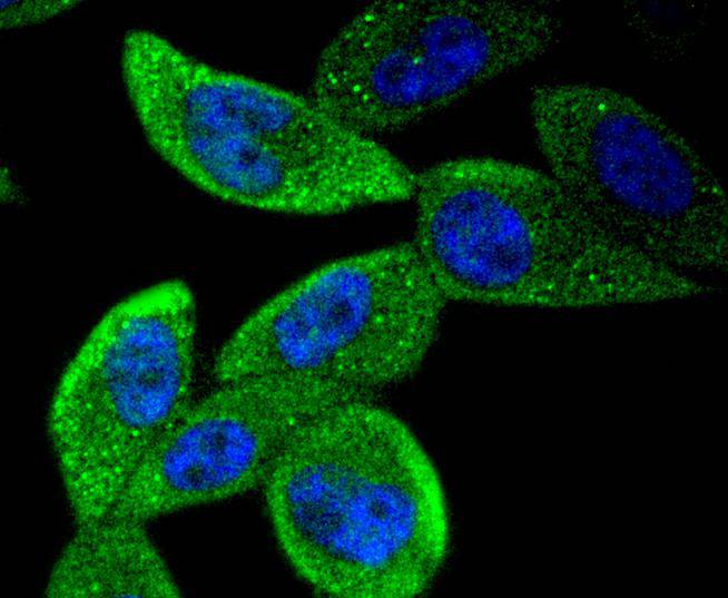 ICC staining of STAT5b in PC-3M cells (green). Formalin fixed cells were permeabilized with 0.1% Triton X-100 in TBS for 10 minutes at room temperature and blocked with 10% negative goat serum for 15 minutes at room temperature. Cells were probed with the primary antibody (ET1612-63, 1/50) for 1 hour at room temperature, washed with PBS. Alexa Fluor®488 conjugate-Goat anti-Rabbit IgG was used as the secondary antibody at 1/1,000 dilution. The nuclear counter stain is DAPI (blue).