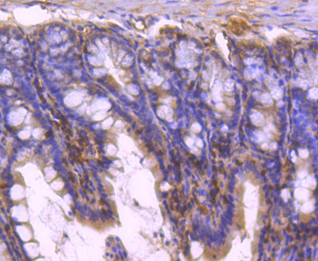 Immunohistochemical analysis of paraffin-embedded mouse colon tissue using anti-STAT5b antibody. The section was pre-treated using heat mediated antigen retrieval with Tris-EDTA buffer (pH 9.0) for 20 minutes.The tissues were blocked in 1% BSA for 30 minutes at room temperature, washed with ddH2O and PBS, and then probed with the primary antibody (ET1612-63, 1/50) for 30 minutes at room temperature. The detection was performed using an HRP conjugated compact polymer system. DAB was used as the chromogen. Tissues were counterstained with hematoxylin and mounted with DPX.
