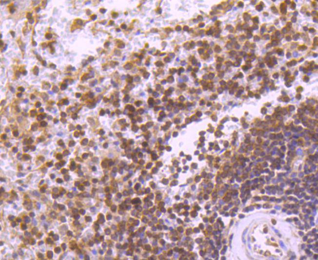 Immunohistochemical analysis of paraffin-embedded human spleen tissue using anti-STAT5b antibody. The section was pre-treated using heat mediated antigen retrieval with Tris-EDTA buffer (pH 9.0) for 20 minutes.The tissues were blocked in 1% BSA for 30 minutes at room temperature, washed with ddH2O and PBS, and then probed with the primary antibody (ET1612-63, 1/50) for 30 minutes at room temperature. The detection was performed using an HRP conjugated compact polymer system. DAB was used as the chromogen. Tissues were counterstained with hematoxylin and mounted with DPX.