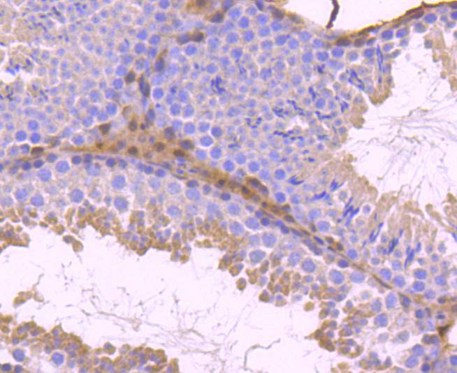 Immunohistochemical analysis of paraffin-embedded mouse testis tissue using anti-STAT5b antibody. The section was pre-treated using heat mediated antigen retrieval with Tris-EDTA buffer (pH 9.0) for 20 minutes.The tissues were blocked in 1% BSA for 30 minutes at room temperature, washed with ddH2O and PBS, and then probed with the primary antibody (ET1612-63, 1/50) for 30 minutes at room temperature. The detection was performed using an HRP conjugated compact polymer system. DAB was used as the chromogen. Tissues were counterstained with hematoxylin and mounted with DPX.