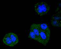ICC staining of DYNLL1 in Hela cells (green). Formalin fixed cells were permeabilized with 0.1% Triton X-100 in TBS for 10 minutes at room temperature and blocked with 1% Blocker BSA for 15 minutes at room temperature. Cells were probed with the primary antibody (ET1612-64, 1/50) for 1 hour at room temperature, washed with PBS. Alexa Fluor®488 Goat anti-Rabbit IgG was used as the secondary antibody at 1/1,000 dilution. The nuclear counter stain is DAPI (blue).