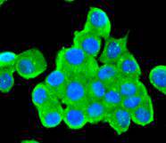 ICC staining Tyrosine Hydroxylase in N2A cells (green). The nuclear counter stain is DAPI (blue). Cells were fixed in paraformaldehyde, permeabilised with 0.25% Triton X100/PBS.