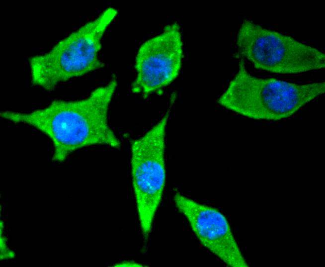 ICC staining Tyrosine Hydroxylase in SH-SY-5Y cells (green). The nuclear counter stain is DAPI (blue). Cells were fixed in paraformaldehyde, permeabilised with 0.25% Triton X100/PBS.