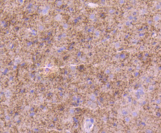 Immunohistochemical analysis of paraffin-embedded rat brain tissue using anti-Tyrosine Hydroxylase antibody. Counter stained with hematoxylin.