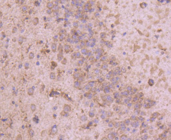 Immunohistochemical analysis of paraffin-embedded mouse brain tissue using anti-Tyrosine Hydroxylase antibody. Counter stained with hematoxylin.