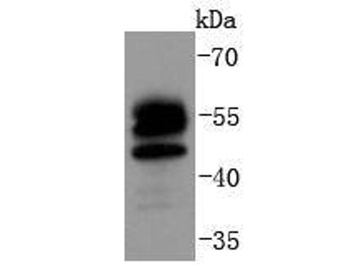 Western blot analysis of FOXO4 on human lung tissue lysates. Proteins were transferred to a PVDF membrane and blocked with 5% BSA in PBS for 1 hour at room temperature. The primary antibody (ET1612-66, 1/500) was used in 5% BSA at room temperature for 2 hours. Goat Anti-Rabbit IgG - HRP Secondary Antibody (HA1001) at 1:50,000 dilution was used for 1 hour at room temperature.