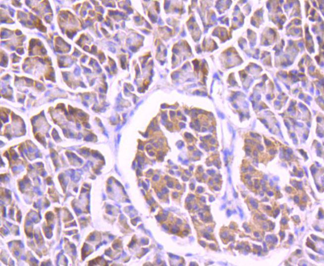 Immunohistochemical analysis of paraffin-embedded human pancreas tissue using anti-FOXO4 antibody. The section was pre-treated using heat mediated antigen retrieval with Tris-EDTA buffer (pH 8.0-8.4) for 20 minutes.The tissues were blocked in 5% BSA for 30 minutes at room temperature, washed with ddH2O and PBS, and then probed with the primary antibody (ET1612-66, 1/50) for 30 minutes at room temperature. The detection was performed using an HRP conjugated compact polymer system. DAB was used as the chromogen. Tissues were counterstained with hematoxylin and mounted with DPX.