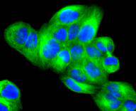 ICC staining JNK3 in Hela cells (green). The nuclear counter stain is DAPI (blue). Cells were fixed in paraformaldehyde, permeabilised with 0.25% Triton X100/PBS.
