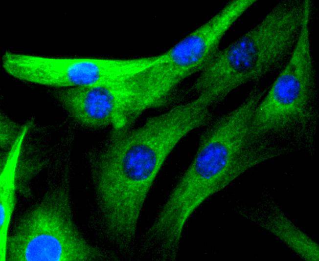 ICC staining JNK3 in NIH/3T3 cells (green). The nuclear counter stain is DAPI (blue). Cells were fixed in paraformaldehyde, permeabilised with 0.25% Triton X100/PBS.