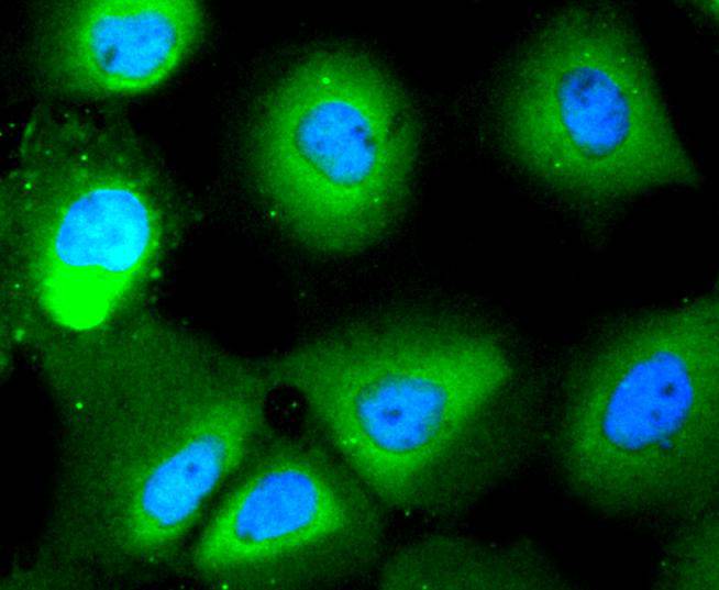 ICC staining of HDAC10 in A431 cells (green). Formalin fixed cells were permeabilized with 0.1% Triton X-100 in TBS for 10 minutes at room temperature and blocked with 10% negative goat serum for 15 minutes at room temperature. Cells were probed with the primary antibody (ET1612-69, 1/50) for 1 hour at room temperature, washed with PBS. Alexa Fluor®488 conjugate-Goat anti-Rabbit IgG was used as the secondary antibody at 1/1,000 dilution. The nuclear counter stain is DAPI (blue).