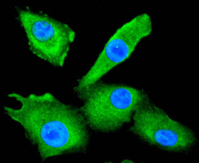 ICC staining of HDAC10 in A549 cells (green). Formalin fixed cells were permeabilized with 0.1% Triton X-100 in TBS for 10 minutes at room temperature and blocked with 10% negative goat serum for 15 minutes at room temperature. Cells were probed with the primary antibody (ET1612-69, 1/50) for 1 hour at room temperature, washed with PBS. Alexa Fluor®488 conjugate-Goat anti-Rabbit IgG was used as the secondary antibody at 1/1,000 dilution. The nuclear counter stain is DAPI (blue).