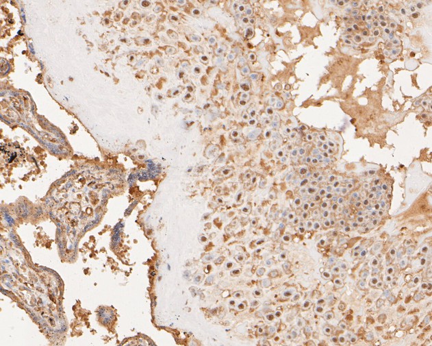 Immunohistochemical analysis of paraffin-embedded human placenta tissue using anti-HDAC10 antibody. The section was pre-treated using heat mediated antigen retrieval with Tris-EDTA buffer (pH 9.0) for 20 minutes.The tissues were blocked in 1% BSA for 30 minutes at room temperature, washed with ddH2O and PBS, and then probed with the primary antibody (ET1612-69, 1/50) for 30 minutes at room temperature. The detection was performed using an HRP conjugated compact polymer system. DAB was used as the chromogen. Tissues were counterstained with hematoxylin and mounted with DPX.
