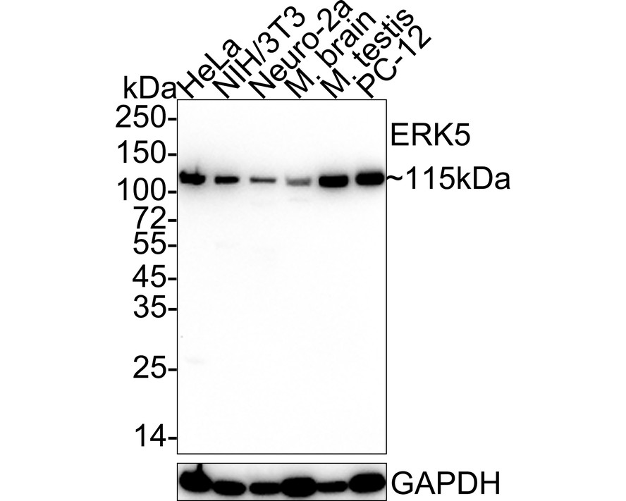 Western blot analysis of ERK5 on different lysates. Proteins were transferred to a PVDF membrane and blocked with 5% BSA in PBS for 1 hour at room temperature. The primary antibody (ET1612-7, 1/500) was used in 5% BSA at room temperature for 2 hours. Goat Anti-Rabbit IgG - HRP Secondary Antibody (HA1001) at 1:5,000 dilution was used for 1 hour at room temperature.<br />
Positive control: <br />
Lane 1: Hela cell lysate<br />
Lane 2: K562 cell lysate<br />
Lane 3: mouse brain tissue lysate
