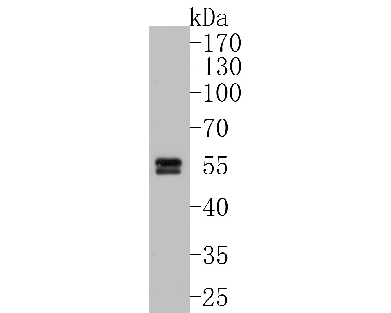 Western blot analysis of Caspase-8 on Jurkat cell lysates. Proteins were transferred to a PVDF membrane and blocked with 5% BSA in PBS for 1 hour at room temperature. The primary antibody (ET1612-70, 1/500) was used in 5% BSA at room temperature for 2 hours. Goat Anti-Rabbit IgG - HRP Secondary Antibody (HA1001) at 1:5,000 dilution was used for 1 hour at room temperature.