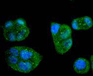 ICC staining of Caspase-8 in Hela cells (green). Formalin fixed cells were permeabilized with 0.1% Triton X-100 in TBS for 10 minutes at room temperature and blocked with 1% Blocker BSA for 15 minutes at room temperature. Cells were probed with the primary antibody (ET1612-70, 1/50) for 1 hour at room temperature, washed with PBS. Alexa Fluor®488 Goat anti-Rabbit IgG was used as the secondary antibody at 1/1,000 dilution. The nuclear counter stain is DAPI (blue).