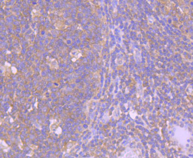 Immunohistochemical analysis of paraffin-embedded human tonsil tissue using anti-Caspase-8 antibody. The section was pre-treated using heat mediated antigen retrieval with Tris-EDTA buffer (pH 8.0-8.4) for 20 minutes.The tissues were blocked in 5% BSA for 30 minutes at room temperature, washed with ddH2O and PBS, and then probed with the primary antibody (ET1612-70, 1/50) for 30 minutes at room temperature. The detection was performed using an HRP conjugated compact polymer system. DAB was used as the chromogen. Tissues were counterstained with hematoxylin and mounted with DPX.