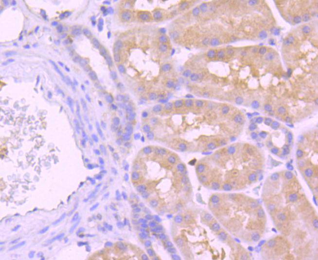 Immunohistochemical analysis of paraffin-embedded human kidney tissue using anti-Caspase-8 antibody. The section was pre-treated using heat mediated antigen retrieval with Tris-EDTA buffer (pH 8.0-8.4) for 20 minutes.The tissues were blocked in 5% BSA for 30 minutes at room temperature, washed with ddH2O and PBS, and then probed with the primary antibody (ET1612-70, 1/50) for 30 minutes at room temperature. The detection was performed using an HRP conjugated compact polymer system. DAB was used as the chromogen. Tissues were counterstained with hematoxylin and mounted with DPX.