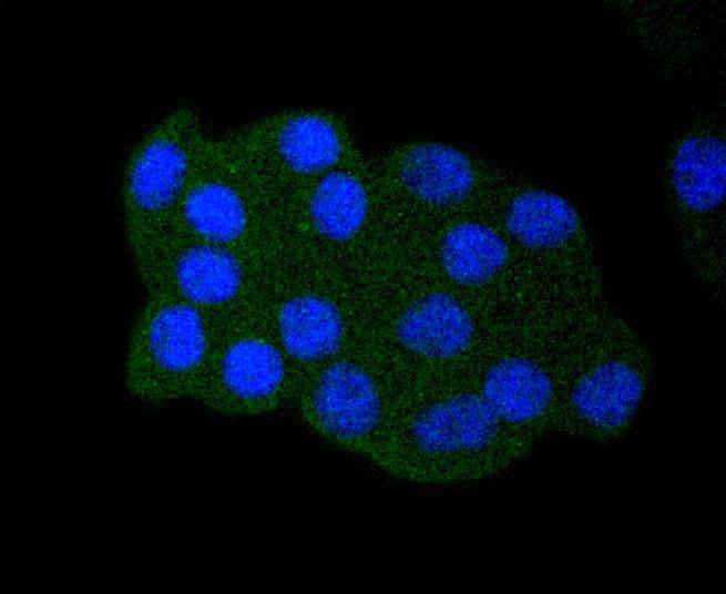 ICC staining of p53 (acetyl K382) in HepG2 cells (green). Formalin fixed cells were permeabilized with 0.1% Triton X-100 in TBS for 10 minutes at room temperature and blocked with 1% Blocker BSA for 15 minutes at room temperature. Cells were probed with the primary antibody (ET1612-71, 1/50) for 1 hour at room temperature, washed with PBS. Alexa Fluor®488 Goat anti-Rabbit IgG was used as the secondary antibody at 1/1,000 dilution. The nuclear counter stain is DAPI (blue).