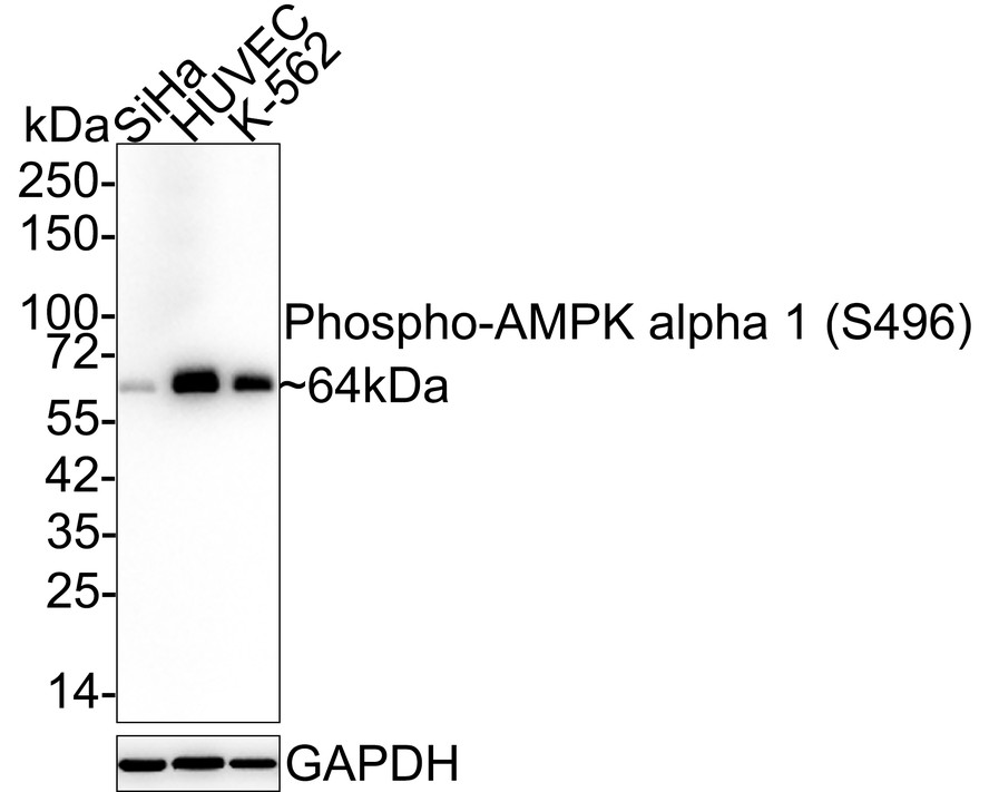 Western blot analysis of Phospho-AMPK alpha 1 (S496) on different lysates with Rabbit anti-Phospho-AMPK alpha 1 (S496) antibody (ET1612-72) at 1/1,000 dilution.<br />
<br />
Lane 1: 293T cell lysate<br />
Lane 2: SiHa cell lysate<br />
Lane 3: HUVEC cell lysate<br />
<br />
Lysates/proteins at 10 µg/Lane.<br />
<br />
Predicted band size: 64 kDa<br />
Observed band size: 64 kDa<br />
<br />
Exposure time: 2 minutes;<br />
<br />
8% SDS-PAGE gel.<br />
<br />
Proteins were transferred to a PVDF membrane and blocked with 5% NFDM/TBST for 1 hour at room temperature. The primary antibody (ET1612-72) at 1/1,000 dilution was used in 5% NFDM/TBST at room temperature for 2 hours. Goat Anti-Rabbit IgG - HRP Secondary Antibody (HA1001) at 1:300,000 dilution was used for 1 hour at room temperature.