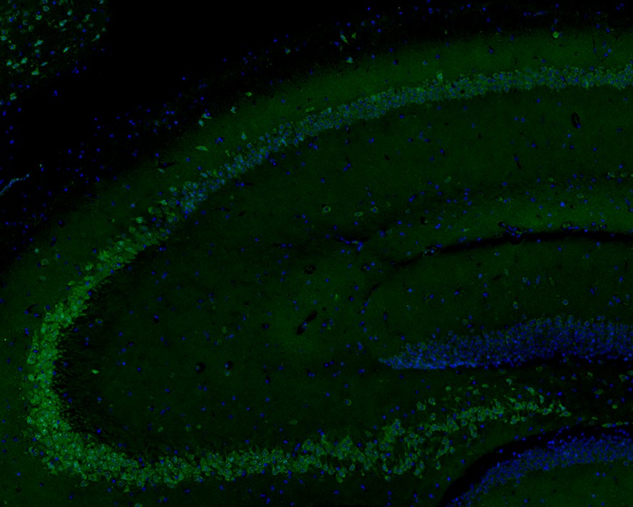 ICC staining of Phospho-AMPK alpha 1 (S496) in Hela cells (green). Formalin fixed cells were permeabilized with 0.1% Triton X-100 in TBS for 10 minutes at room temperature and blocked with 1% Blocker BSA for 15 minutes at room temperature. Cells were probed with the primary antibody (ET1612-72, 1/50) for 1 hour at room temperature, washed with PBS. Alexa Fluor®488 Goat anti-Rabbit IgG was used as the secondary antibody at 1/1,000 dilution. The nuclear counter stain is DAPI (blue).