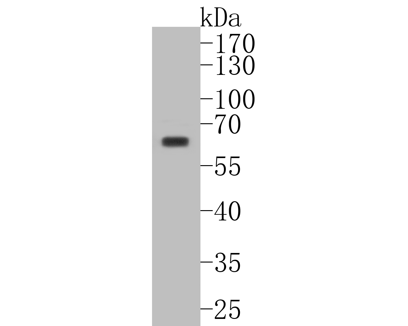 Western blot analysis of Phospho-AKT1 (T450) on MCF-7 cell lysates. Proteins were transferred to a PVDF membrane and blocked with 5% BSA in PBS for 1 hour at room temperature. The primary antibody (ET1612-73, 1/500) was used in 5% BSA at room temperature for 2 hours. Goat Anti-Rabbit IgG - HRP Secondary Antibody (HA1001) at 1:5,000 dilution was used for 1 hour at room temperature.
