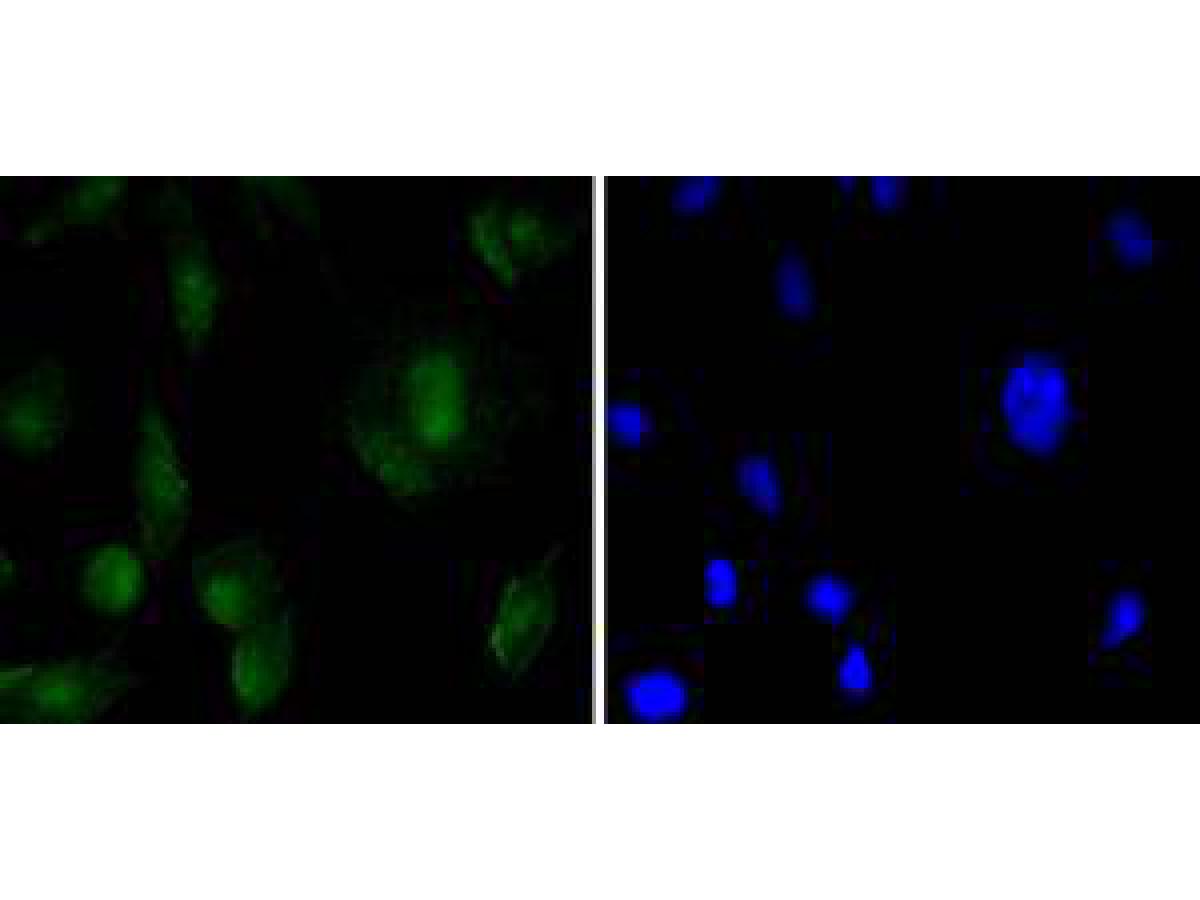ICC staining of SOX11 in SH-SY5Y cells (green). Formalin fixed cells were permeabilized with 0.1% Triton X-100 in TBS for 10 minutes at room temperature and blocked with 1% Blocker BSA for 15 minutes at room temperature. Cells were probed with the primary antibody (ET1612-76, 1/50) for 1 hour at room temperature, washed with PBS. Alexa Fluor®488 Goat anti-Rabbit IgG was used as the secondary antibody at 1/1,000 dilution. The nuclear counter stain is DAPI (blue).