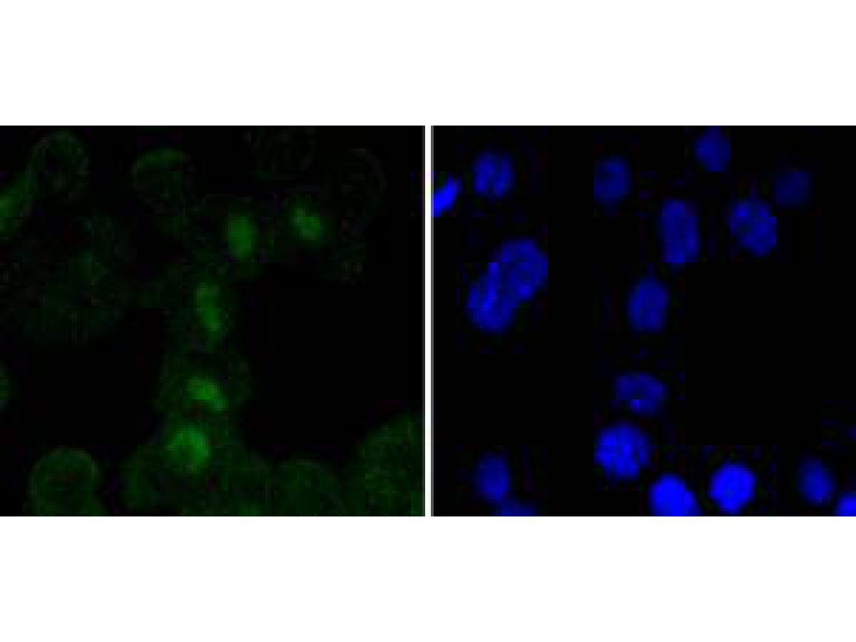 ICC staining of SOX11 in N2A cells (green). Formalin fixed cells were permeabilized with 0.1% Triton X-100 in TBS for 10 minutes at room temperature and blocked with 1% Blocker BSA for 15 minutes at room temperature. Cells were probed with the primary antibody (ET1612-76, 1/50) for 1 hour at room temperature, washed with PBS. Alexa Fluor®488 Goat anti-Rabbit IgG was used as the secondary antibody at 1/1,000 dilution. The nuclear counter stain is DAPI (blue).
